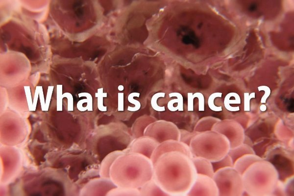 Cancer – General Overview.